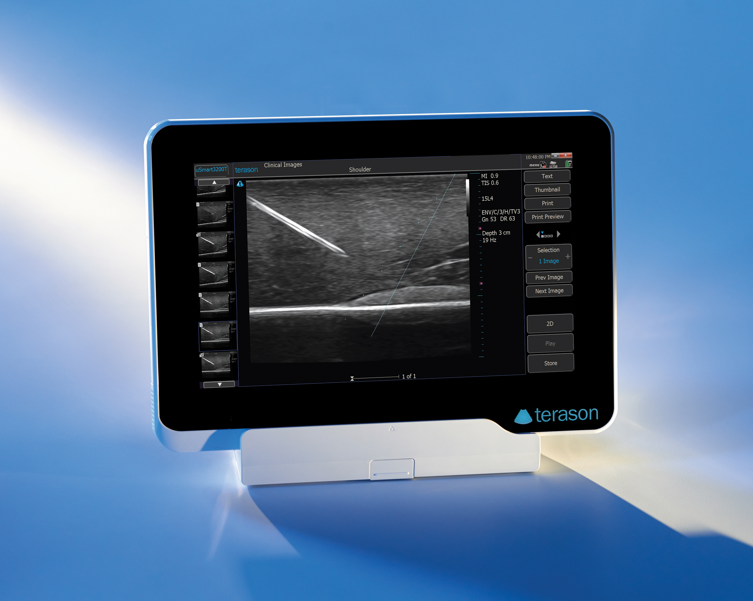 Terason ultrasound